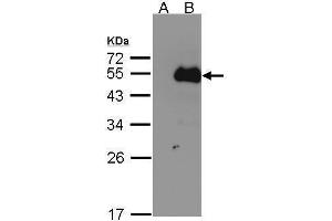 WB Image Western Blot analysis of NFIB expression in transfected 293T cell line by NFIB polyclonal antibody. (NFIB 抗体)