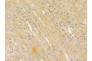 anti-Proteasome (Prosome, Macropain) 26S Subunit, Non-ATPase, 6 (PSMD6) (N-Term) antibody