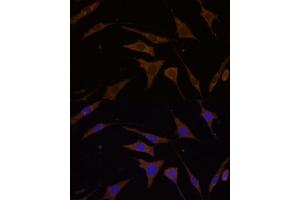 Immunofluorescence analysis of L929 cells using RPL7 Polyclonal Antibody (ABIN6128656, ABIN6147148, ABIN6147149 and ABIN6221631) at dilution of 1:100 (40x lens). (RPL7 抗体  (AA 1-248))