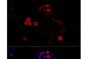 Immunofluorescence analysis of HeLa cells using FLNA Polyclonal Antibody at dilution of 1:100 (40x lens). (Filamin A 抗体)