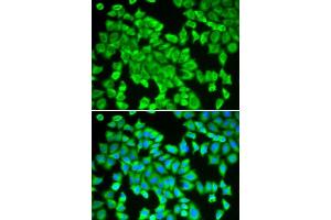 Immunofluorescence analysis of HeLa cells using STIP1 antibody. (STIP1 抗体  (AA 1-300))