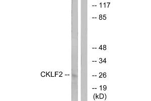 Western blot analysis of extracts from K562 cells, using CKLF2 antibody. (CKLF 抗体  (C-Term))