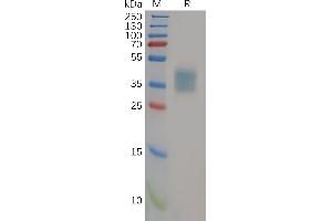 Human IL21R Protein, His Tag on SDS-PAGE under reducing condition.