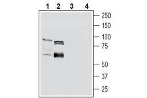 Western blot analysis of mouse kidney lysates (lanes 1 and 3) and rat small intestine lysates (lanes 2 and 4): - 1-2. (SLC22A4 抗体  (Intracellular))