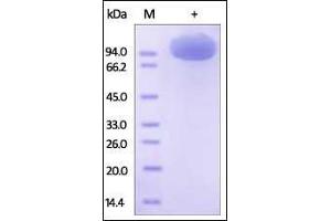 Human M-CSF R, Fc Tag on SDS-PAGE under reducing (R) condition. (CSF1R Protein (AA 20-512) (Fc Tag))