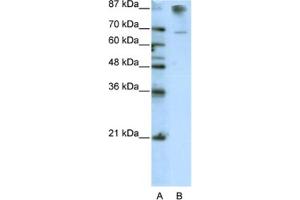 Western Blotting (WB) image for anti-HKR1, GLI-Kruppel Zinc Finger Family Member (HKR1) antibody (ABIN2462014) (HKR1 抗体)
