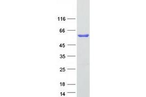 Western Blotting (WB) image for STAM Binding Protein (STAMBP) (Transcript Variant 2) protein (Myc-DYKDDDDK Tag) (ABIN2732752)