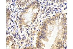 Immunohistochemistry analysis of paraffin-embedded human colon using CDC25A Polyclonal Antibody at dilution of 1:1000. (CDC25A 抗体)