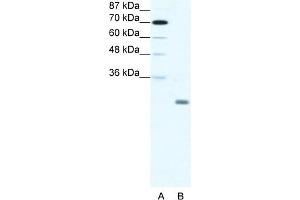 WB Suggested Anti-ID4 Antibody Titration:  1. (ID4 抗体  (N-Term))