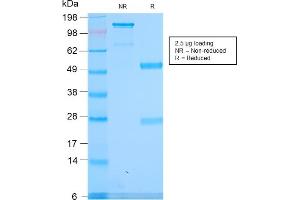 SDS-PAGE (SDS) image for anti-Spectrin alpha 1, Erythrocytic (SPTA1) (AA 356-475) antibody (ABIN6940646)