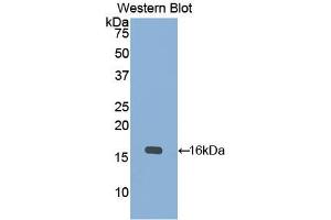 Western blot analysis of the recombinant protein. (KRT15 抗体  (AA 274-399))