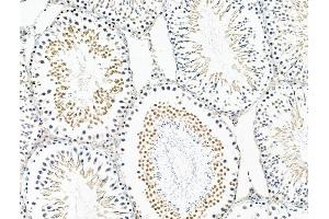 ABIN6263956 and ABIN6268907 at 1/100 staining Rat testis tissue by IHC-P.