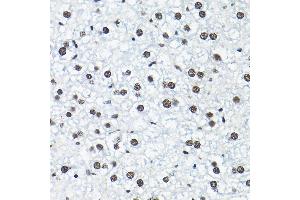 Immunohistochemistry of paraffin-embedded mouse liver using SNRP Rabbit pAb (2161) at dilution of 1:200 (40x lens). (SNRPA1 抗体  (AA 1-220))