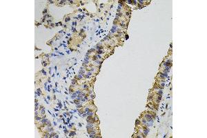 Immunohistochemistry of paraffin-embedded mouse lung using DNM2 antibody. (DNM2 抗体)