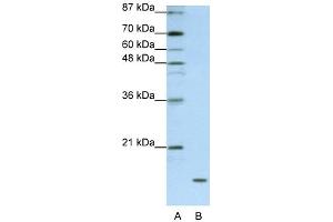 WB Suggested Anti-FAM121B Antibody Titration:  1. (APOO 抗体  (C-Term))