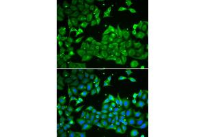 Immunofluorescence analysis of HeLa cells using ALDH3A1 antibody. (ALDH3A1 抗体)