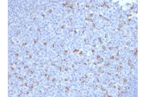 Formalin-fixed, paraffin-embedded human Tonsil stained with PD1 (CD279) Mouse Monoclonal Antibody (PDCD1/2720). (PD-1 抗体)