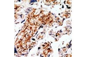 Immunohistochemical analysis of RLK staining in human placenta formalin fixed paraffin embedded tissue section. (TXK 抗体)