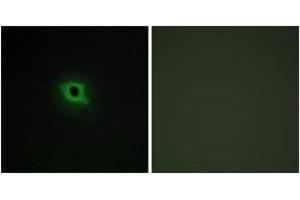 Immunofluorescence (IF) image for anti-Cyclin B3 (CCNB3) (AA 1221-1270) antibody (ABIN2889635) (Cyclin B3 抗体  (AA 1221-1270))