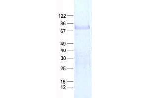 ZNF264 Protein (His tag)