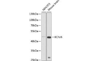Western blot analysis of extracts of various cell lines, using KCNJ6 antibody (ABIN6129433, ABIN6142742, ABIN6142743 and ABIN6225263) at 1:1000 dilution. (KCNJ6 抗体  (AA 1-80))