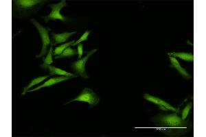 Immunofluorescence of purified MaxPab antibody to C1orf38 on HeLa cell. (C1orf38 抗体  (AA 1-132))