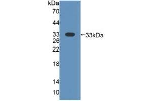 Detection of Recombinant FMO2, Human using Polyclonal Antibody to Flavin Containing Monooxygenase 2, Non Functional (FMO2) (FMO2 抗体  (AA 295-469))
