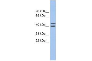 WB Suggested Anti-FBXL14 Antibody Titration: 0. (FBXL14 抗体  (N-Term))