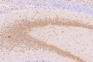 Immunohistochemistry analysis of paraffin-embedded mouse substantia nigra using NMU (ABIN7074818) at dilution of 1: 1000 (Neuromedin U 抗体)