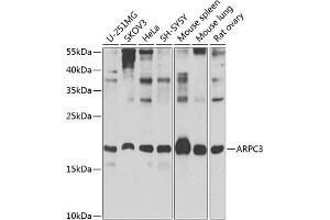 Western blot analysis of extracts of various cell lines, using  Antibody (ABIN6129197, ABIN6137129, ABIN6137130 and ABIN6223718) at 1:1000 dilution. (ARPC3 抗体  (AA 1-178))