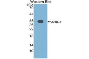 Western Blotting (WB) image for anti-P21-Activated Kinase 1 (PAK1) (AA 252-501) antibody (ABIN1869663) (PAK1 抗体  (AA 252-501))