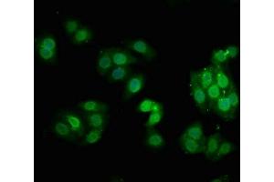 Immunofluorescence staining of HepG2 cells with ABIN7127730 at 1:100,counter-stained with DAPI. (Recombinant PKC alpha 抗体  (pThr638))