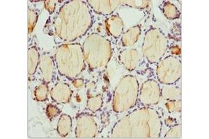 Immunohistochemistry of paraffin-embedded human thyroid tissue using ABIN7163636 at dilution of 1:100 (PLEKHA1 抗体  (AA 285-404))