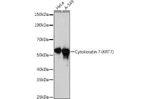 Western blot analysis of extracts of various cell lines, using Cytokeratin 7 (KRT7) (KRT7) Rabbit mAb  at 1:1000 dilution. (Cytokeratin 7 抗体)