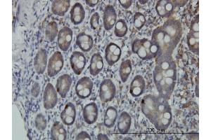 Immunostaining (ISt) image for anti-Proprotein Convertase Subtilisin/kexin Type 1 (PCSK1) (AA 652-753) antibody (ABIN562137)