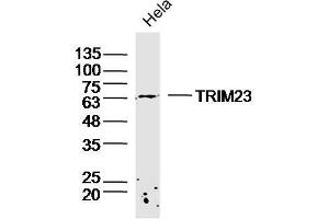 Hela lysates probed with TRIM23 Polyclonal Antibody, Unconjugated  at 1:300 dilution and 4˚C overnight incubation. (TRIM23 抗体  (AA 201-300))