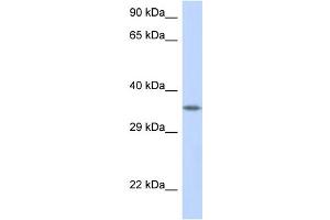WB Suggested Anti-CRK Antibody Titration: 1. (Crk 抗体  (C-Term))