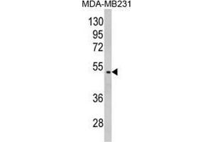 Western blot analysis of GALT Antibody (C-term) in MDA-MB231 cell line lysates (35 µg/lane).
