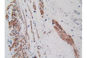 IHC-P analysis of Human Stomach Tissue, with DAB staining. (VEGFR2/CD309 抗体  (AA 46-320))