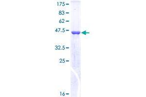 SOD2 Protein (AA 1-222) (GST tag)