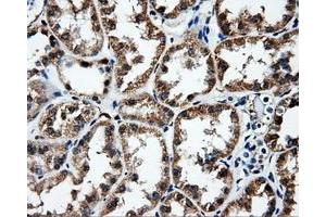Immunohistochemical staining of paraffin-embedded Kidney tissue using anti-FAHD2A mouse monoclonal antibody. (FAHD2A 抗体)