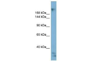 EXPH5 antibody used at 1 ug/ml to detect target protein. (Exophilin 5 抗体  (Middle Region))