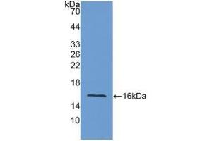 Detection of Recombinant LOXL2, Mouse using Polyclonal Antibody to Lysyl Oxidase Like Protein 2 (LOXL2) (LOXL2 抗体  (AA 53-160))