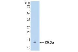 Detection of Recombinant S100A8, Human using Polyclonal Antibody to S100 Calcium Binding Protein A8 (S100A8) (S100A8 抗体  (AA 1-93))