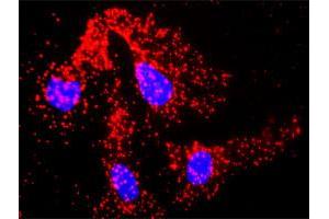 Proximity Ligation Analysis of protein-protein interactions between TRAF2 and ACTG1. (TRAF2 抗体  (AA 1-501))