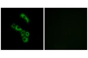 Immunofluorescence analysis of A549 cells, using C1QB antibody. (C1QB 抗体  (C-Term))