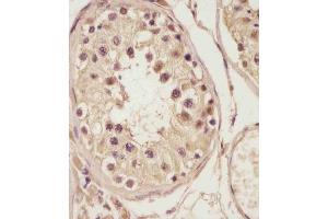 (ABIN6243400 and ABIN6578788) staining NSFL1C in human testis tissue sections by Immunohistochemistry (IHC-P - paraformaldehyde-fixed, paraffin-embedded sections). (NSFL1C 抗体  (AA 214-248))