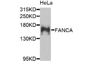 Western blot analysis of extracts of HeLa cells, using FANCA antibody. (FANCA 抗体)