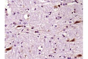 Paraformaldehyde-fixed, paraffin embedded mouse brain, Antigen retrieval by boiling in sodium citrate buffer (pH6) for 15min, Block endogenous peroxidase by 3% hydrogen peroxide for 30 minutes,  Blocking buffer (normal goat serum) at 37°C for 20min, Antibody incubation with LIMK1 Polyclonal Antibody (bs-2775R) at 1:400 overnight at 4°C, followed by a conjugated secondary and DAB staining. (LIM Domain Kinase 1 抗体  (AA 451-550))