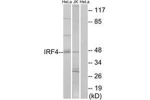 Western blot analysis of extracts from HeLa/Jurkat cells, using IRF4 Antibody. (IRF4 抗体  (AA 281-330))